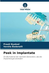 Produktbild: Peek in Implantate