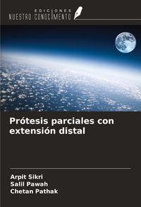 Produktbild: Pr&oacute;tesis parciales con extensi&oacute;n distal
