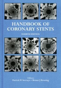 Produktbild: Handbook of Coronary Stents