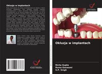Produktbild: Okluzja w implantach