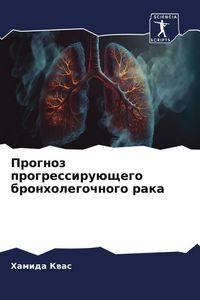 Produktbild: Prognoz progressiru&uuml;schego bronholegochnogo raka