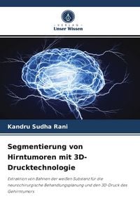 Produktbild: Segmentierung von Hirntumoren mit 3D-Drucktechnologie