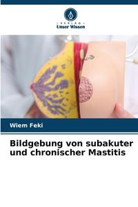Produktbild: Bildgebung von subakuter und chronischer Mastitis