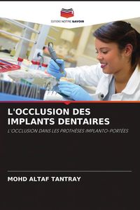 Produktbild: L'occlusion des Implants Dentaires