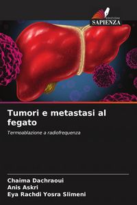Produktbild: Tumori e metastasi al fegato