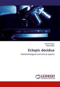 Produktbild: Ectopic decidua