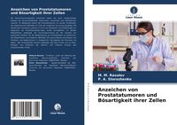 Produktbild: Anzeichen von Prostatatumoren und B&ouml;sartigkeit ihrer Zellen