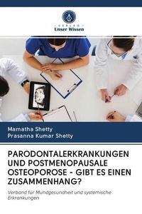 Produktbild: Parodontalerkrankungen und Postmenopausale Osteoporose - Gibt Es Einen Zusammenhang?