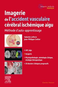 Produktbild: Imagerie de l accident vasculaire