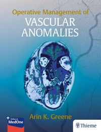 Produktbild: Operative Management of Vascular Anomalies