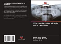 Produktbild: Effets de la radioth&eacute;rapie sur la dentition