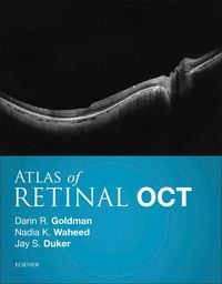 Produktbild: Atlas of Retinal OCT E-Book