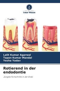 Produktbild: Rotierend in der endodontie