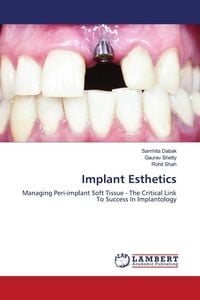 Produktbild: Implant Esthetics
