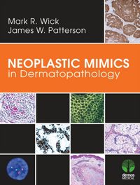 Produktbild: Neoplastic Mimics in Dermatopa