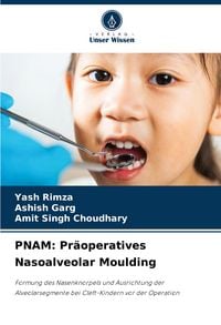 Produktbild: PNAM: Pr&auml;operatives Nasoalveolar Moulding