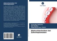 Produktbild: Abdrucktechniken bei Zahnimplantaten