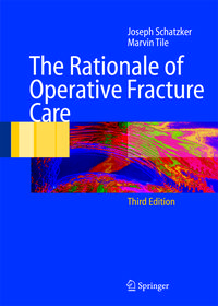Produktbild: The Rationale of Operative Fracture Care