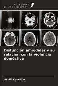 Produktbild: Disfunci&oacute;n amigdalar y su relaci&oacute;n con la violencia dom&eacute;stica