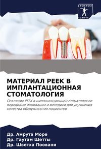 Produktbild: Material Peek V Implantacionnaya Stomatologiya