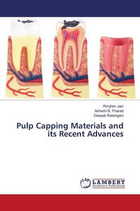 Produktbild: Pulp Capping Materials and its Recent Advances