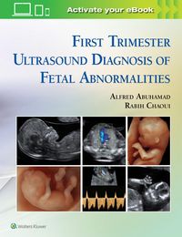 Produktbild: Abuhamad, A: First Trimester Ultrasound Diagnosis of Fetal