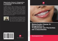 Produktbild: Maloclus&atilde;o Classe II: Diagn&oacute;stico e Tratamento em Pacientes em Crescimento