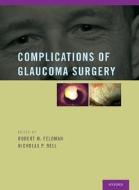 Produktbild: Complications of Glaucoma Surgery