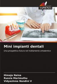 Produktbild: Mini impianti dentali