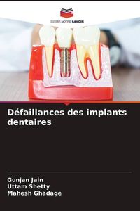 Produktbild: D&eacute;faillances des implants dentaires