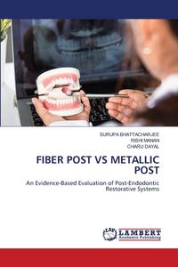 Produktbild: Fiber Post Vs Metallic Post