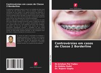 Produktbild: Controv&eacute;rsias em casos de Classe 2 Borderline
