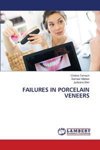 Produktbild: Failures in Porcelain Veneers