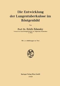 Produktbild: Die Entwicklung der Lungentuberkulose im R&ouml;ntgenbild