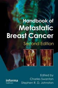 Produktbild: Handbook of Metastatic Breast Cancer