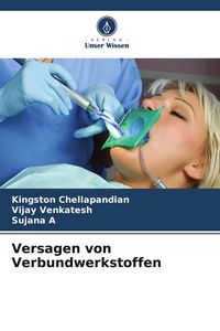 Produktbild: Versagen von Verbundwerkstoffen