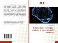 Produktbild: Br&egrave;ches ost&eacute;om&eacute;ning&eacute;es : place de la cisternographie isotopique
