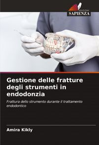 Produktbild: Gestione delle fratture degli strumenti in endodonzia