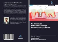 Produktbild: Endosseuze tandheelkundige implantaatsystemen