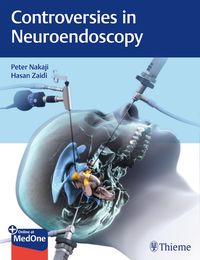 Produktbild: Controversies in Neuroendoscopy