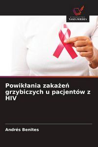 Produktbild: Powik&iquest;ania zaka&iquest;e&iquest; grzybiczych u pacjent&oacute;w z HIV