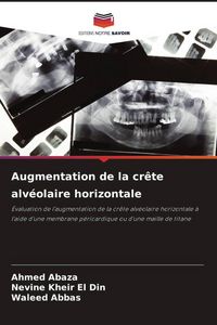 Produktbild: Augmentation de la cr&ecirc;te alv&eacute;olaire horizontale