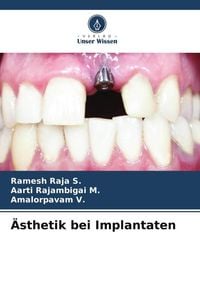 Produktbild: &Auml;sthetik bei Implantaten