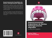 Produktbild: Reposicionamento Espont&acirc;neo de Dentes Patologicamente Migrados