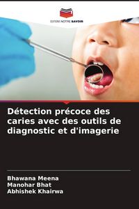 Produktbild: D&eacute;tection pr&eacute;coce des caries avec des outils de diagnostic et d'imagerie