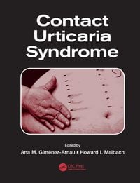 Produktbild: Contact Urticaria Syndrome