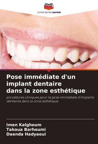 Produktbild: Pose imm&eacute;diate d'un implant dentaire dans la zone esth&eacute;tique