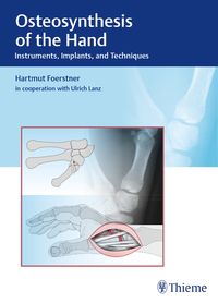 Produktbild: Osteosynthesis of the Hand
