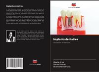 Produktbild: Implants dentaires