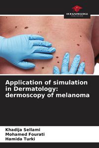 Produktbild: Application of simulation in Dermatology: dermoscopy of melanoma